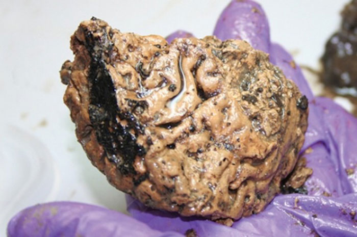 Cerebro de 2600 años